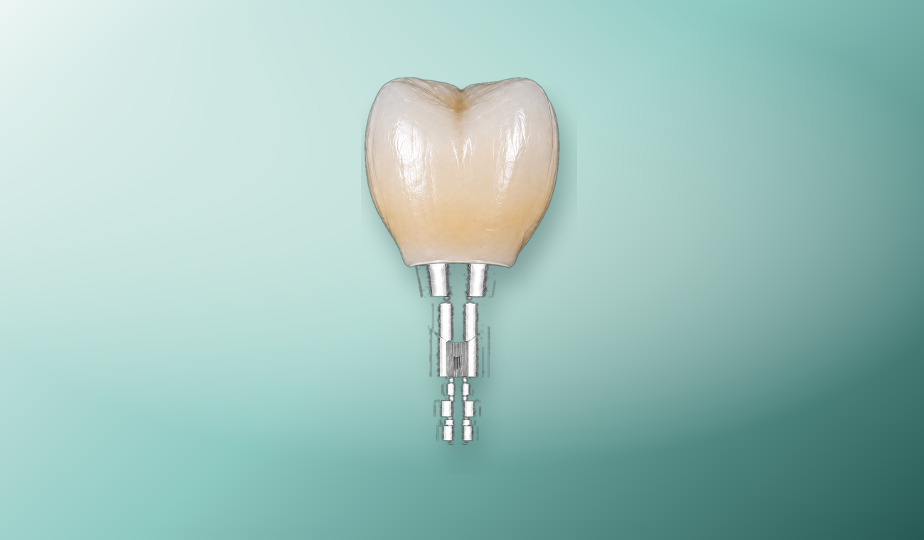 Single implant crown product